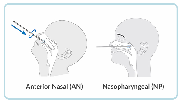nasal-and-nasopharyngeal-demo