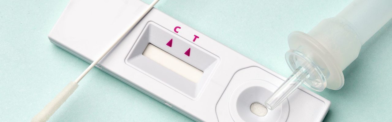 rapid-test-device-covid-19-virus-with-positive-result-close-up-SM_2000x rapid-test-device-covid-19-virus-with-positive-result-close-up-SM_2000x